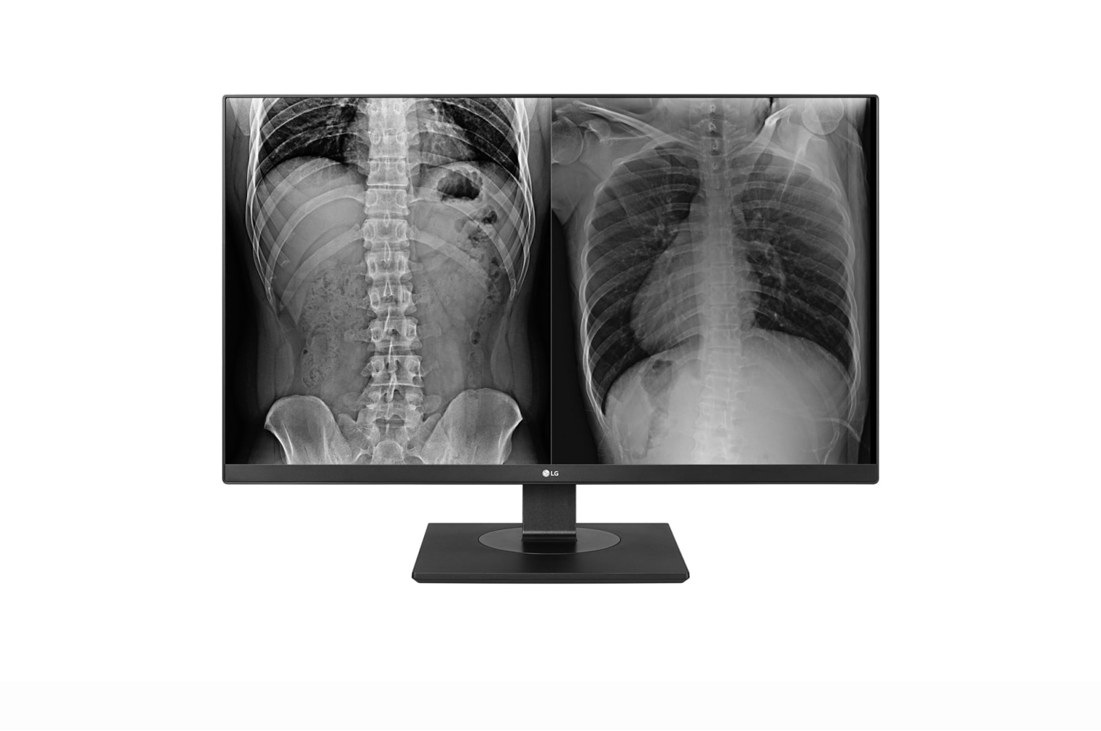 LG 27″ Ultra HD clinical review monitor, front product view