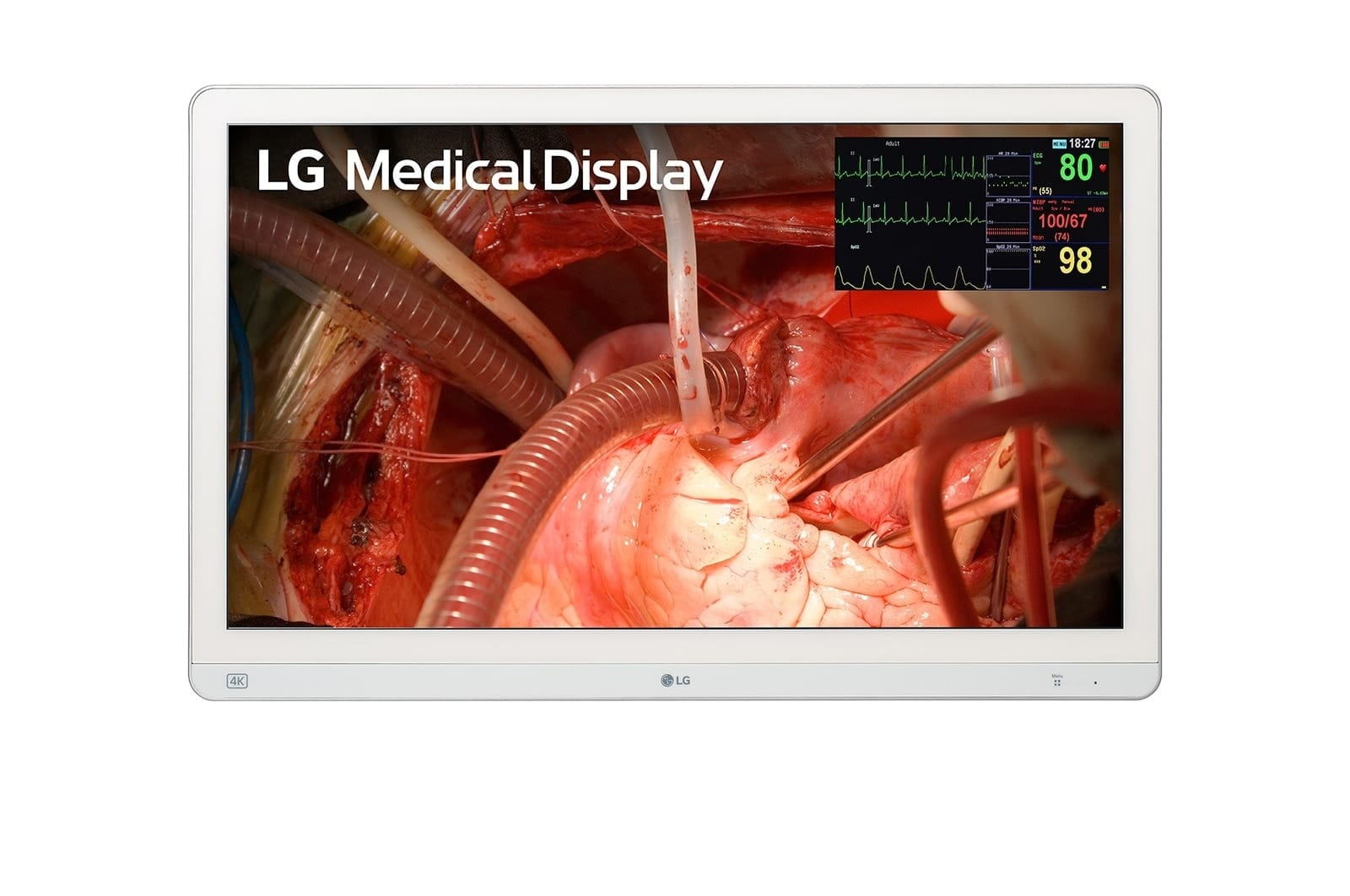 LG 27″ 4K Mini LED surgical monitor, front product view