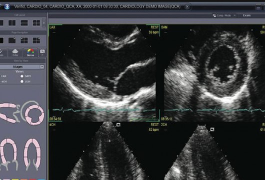 Echocardiography3