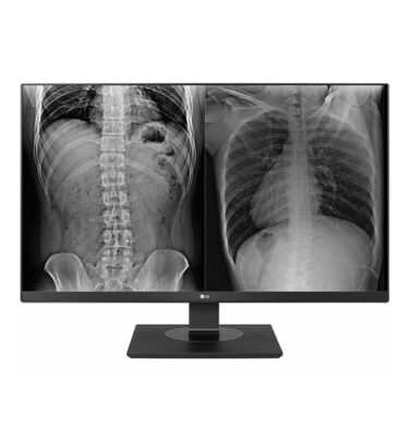 LG: 27” UHD IPS Clinical Review Monitor