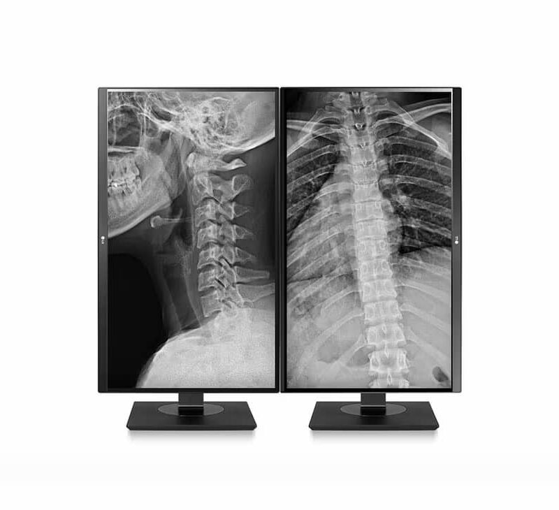 27” UHD IPS Clinical Review Monitor - Image 11