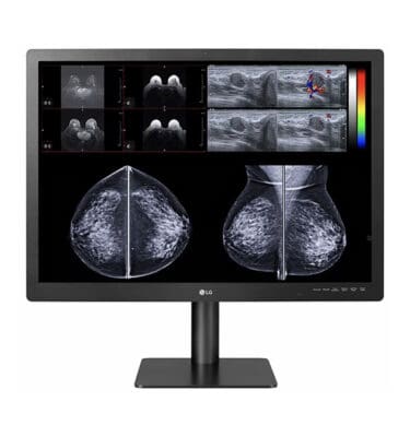 LG: 31'' 12MP IPS Diagnostic Monitor for Mammography