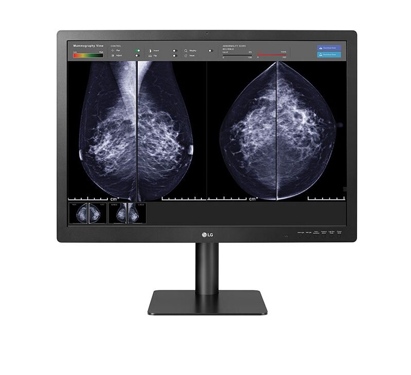 31'' 12MP IPS Diagnostic Monitor for Mammography - Image 10