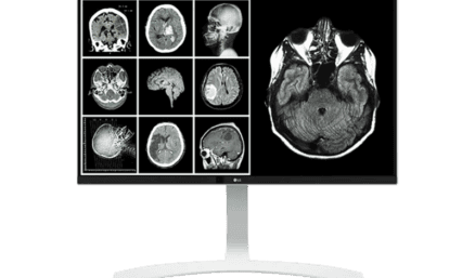 27'' Ultra HD Clinical Review Monitor