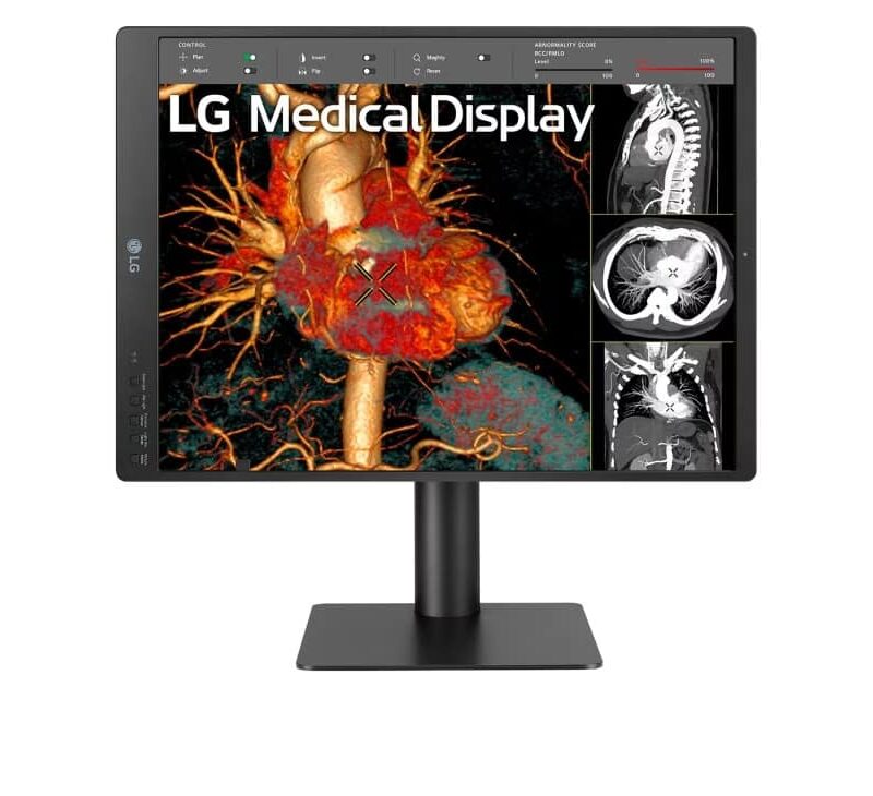 21.3'' 3MP IPS Diagnostic Monitor - Image 2