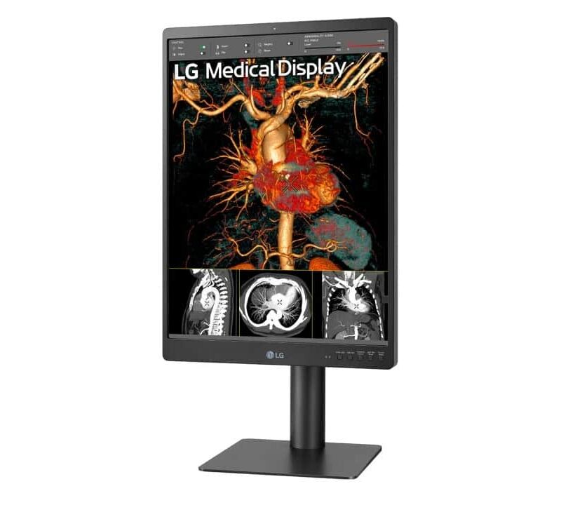 21.3'' 3MP IPS Diagnostic Monitor - Image 3