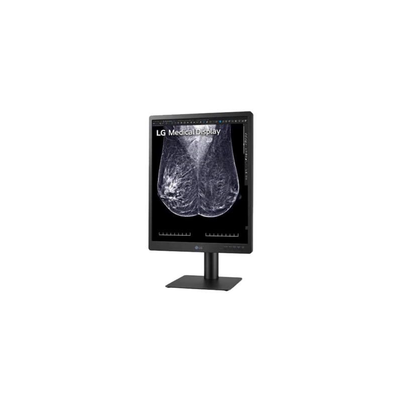 21.3" 5MP IPS Diagnostic Monitor for Mammography | 21HQ613D - Image 2