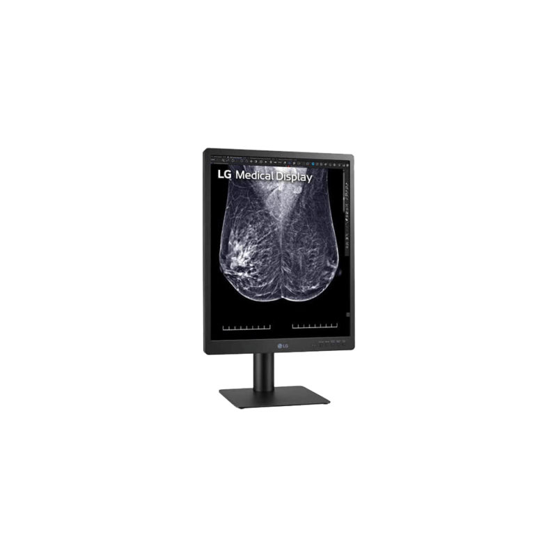 21.3" 5MP IPS Diagnostic Monitor for Mammography | 21HQ613D - Image 3