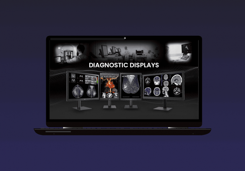 Opened Laptop showing Different types of LG Diagnostic Displays and images of radiologists checking the results of ct scans and xray in the background