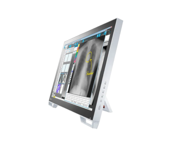 EIZO RadiForce MS236WT-A — 23" Full HD Multi-Touch Medical Monitor - Image 3