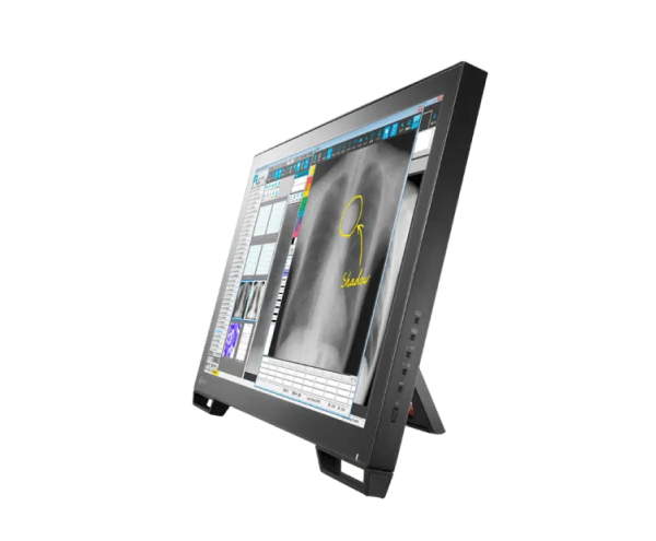 EIZO RadiForce MS236WT-A — 23" Full HD Multi-Touch Medical Monitor - Image 4